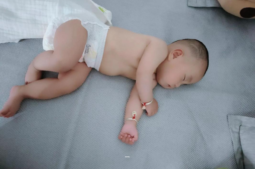 南昌宝宝脸上有白色斑块